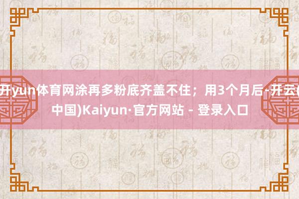 开yun体育网涂再多粉底齐盖不住；用3个月后-开云(中国)Kaiyun·官方网站 - 登录入口